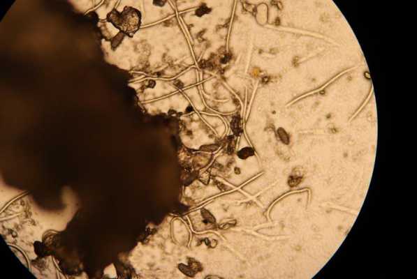 用显微镜观察土壤（用显微镜观察土壤渗水现象）-图3